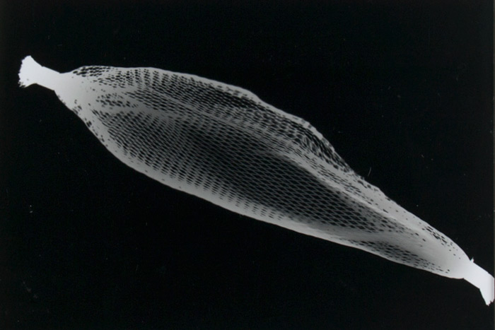 photogram of a garlic net